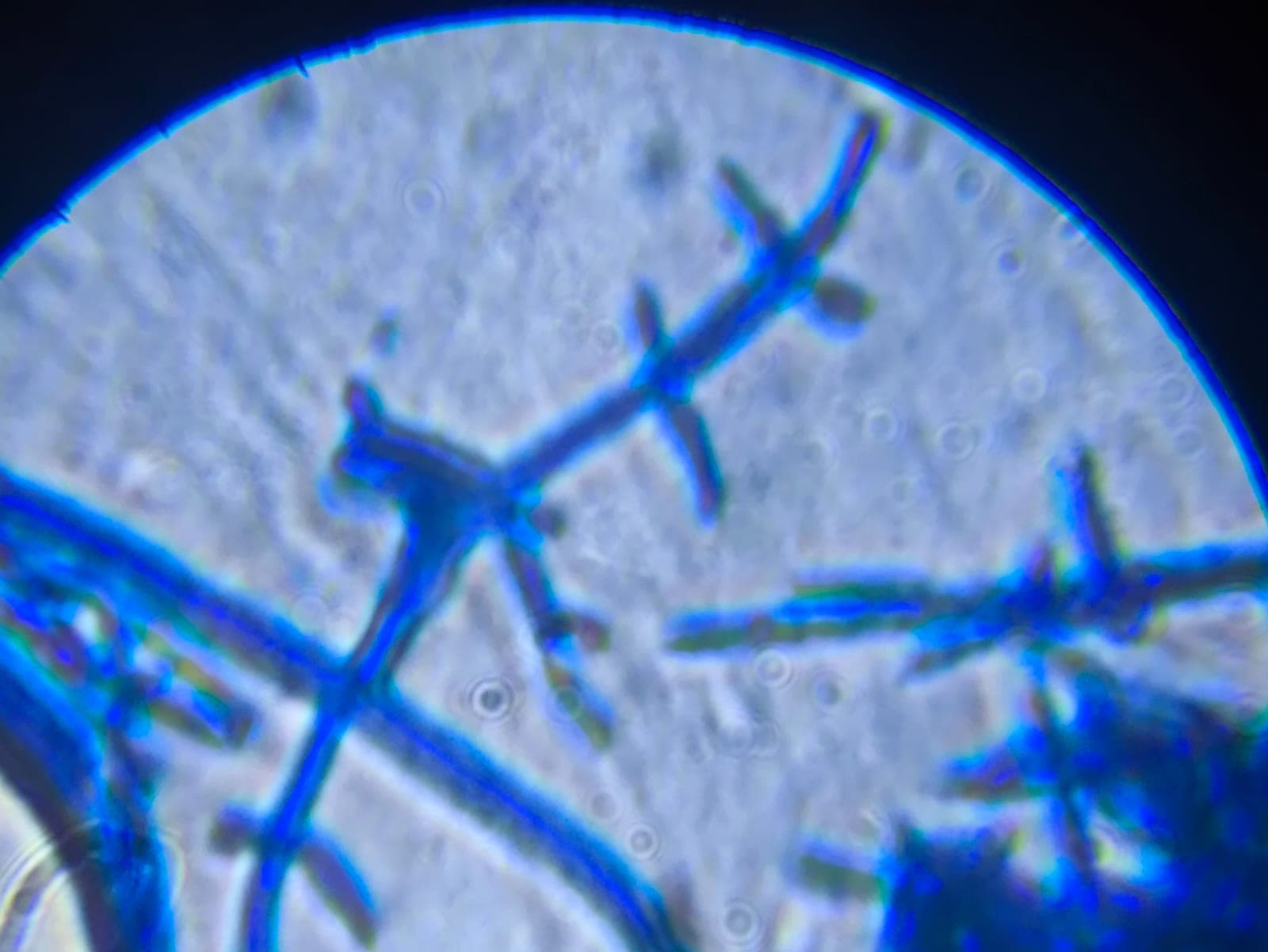 Hifas de Trichoderma harzianum vistas al microscopio